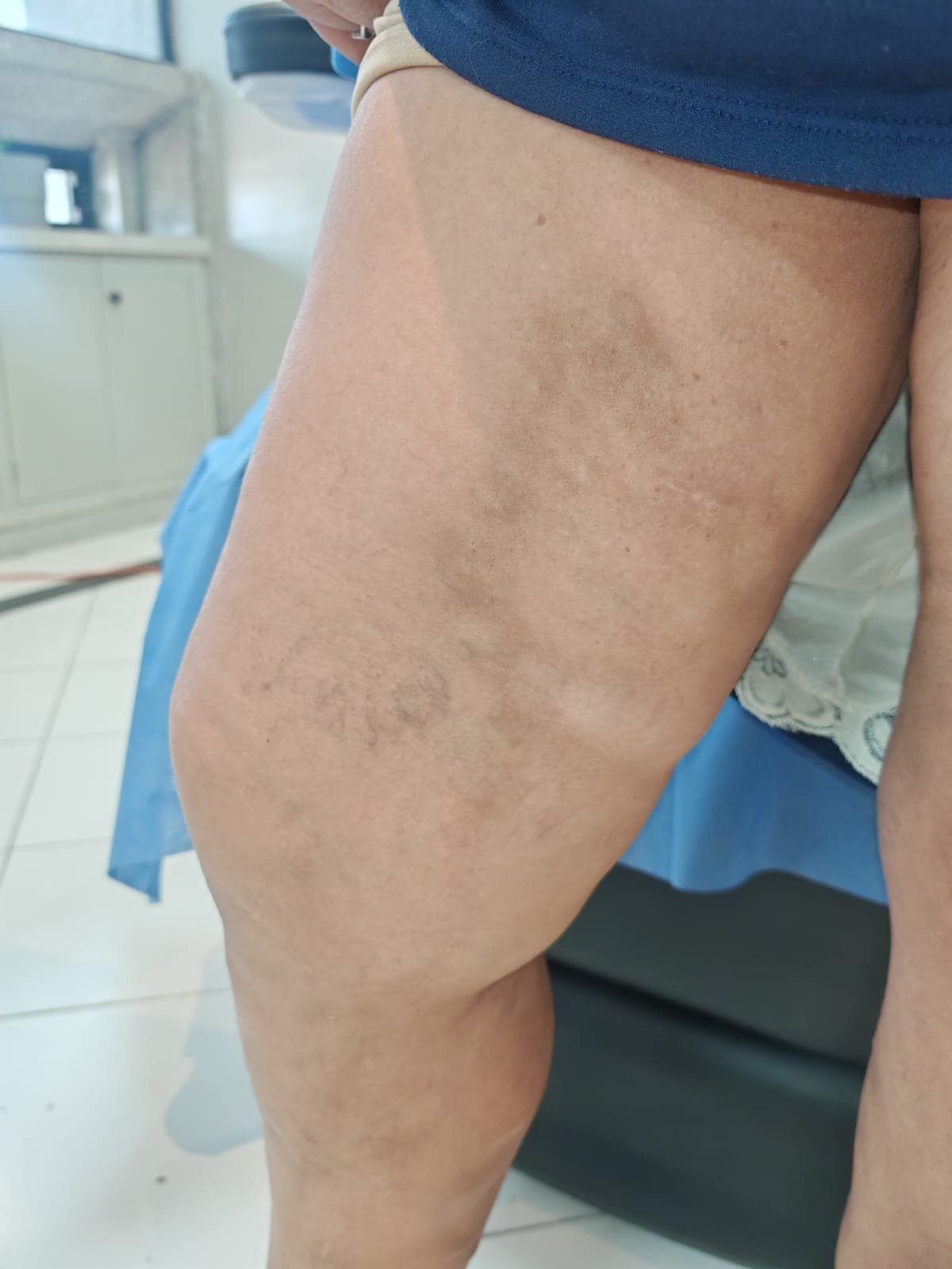 Caso 3 después del tratamiento